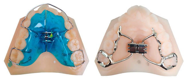 Visuels démontrant la précision et la qualité des moulages issus de l'impression 3D.
