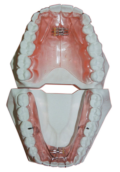 Sport-Roller main image 0